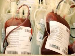 There are no camps due to elections and Diwali, shortage of blood in the government blood bank.